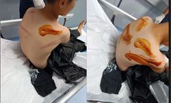 17 yaşındaki çocuk 11 yaşındaki çocuğu döverek hastanelik etti