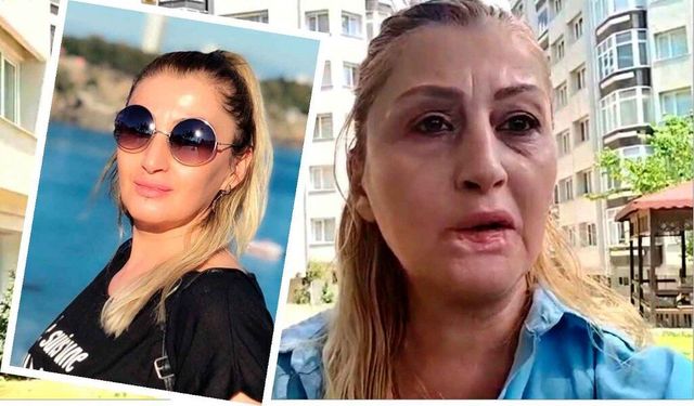 Estetik işlem sonrası dudağı çürüdü: 7 yıldır adalet arıyor