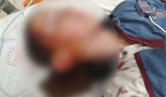 Köpek saldırısında yaralanma davasında emsal niteliğinde karar çıktı
