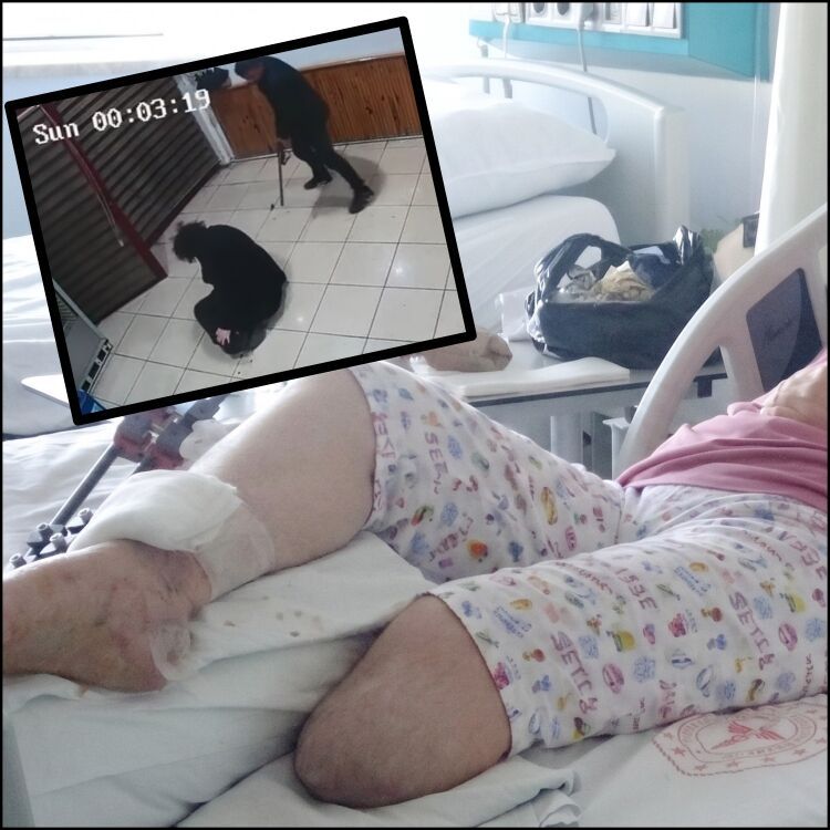 Fethiye'de eşi tarafından vurulan kadın bir bacağını kaybetti