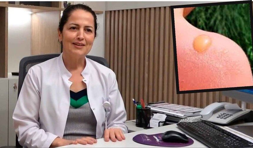Sıcak havalar cilt hastalıklarını tetikliyor