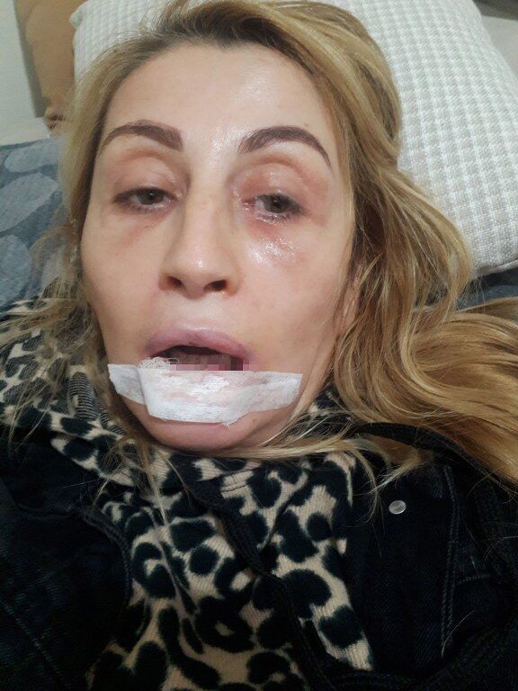 Estetik Mağduru (2) 576X768