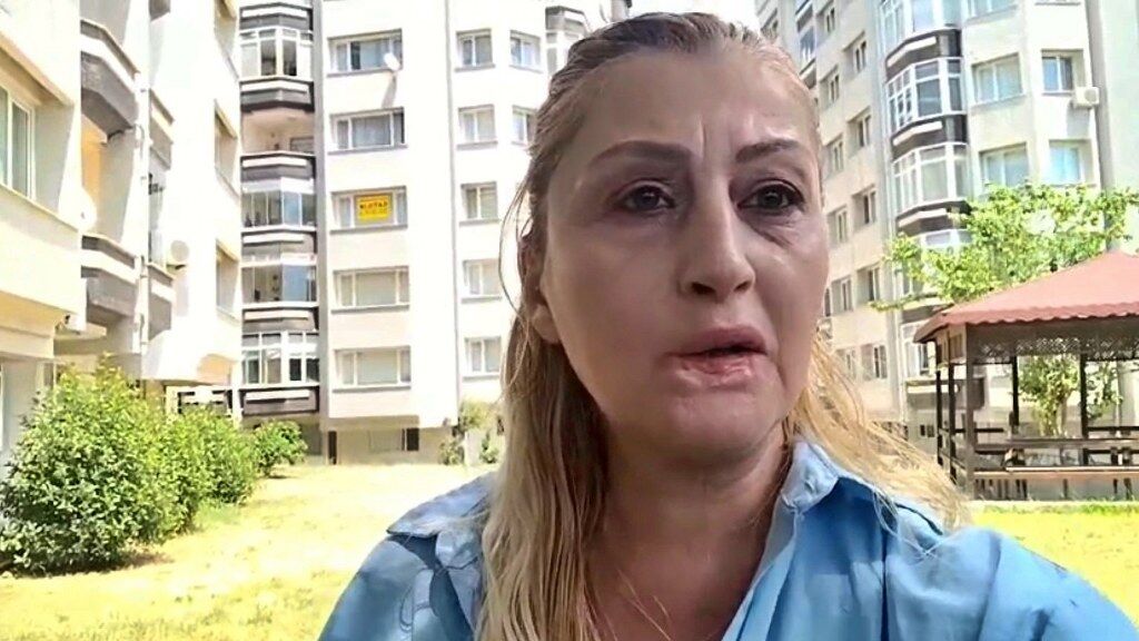 Estetik Mağduru (3) 1024X576